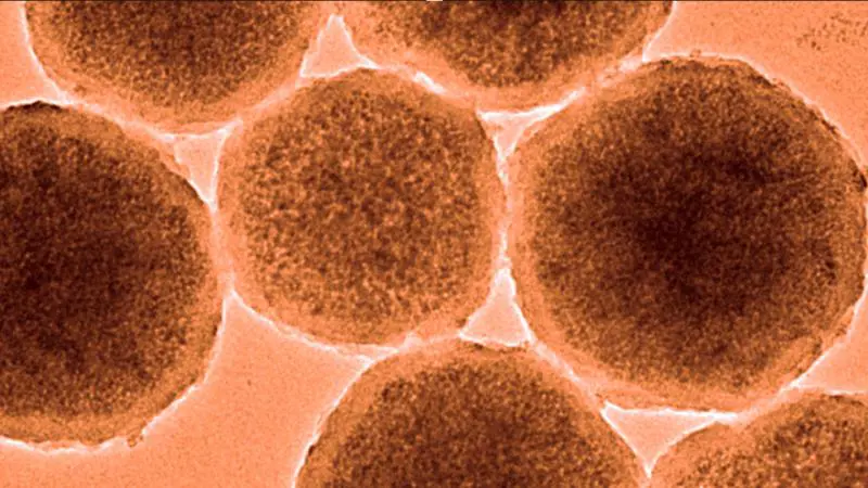 /haberresimleri/2024925/beyin-kanamasini-durdurabilme-potansiyelli-nanorobotlar-uretildiheadLine.webp