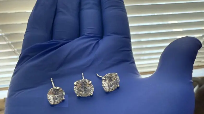 دزێک کە گوارەی بە بەهای ٧٠٠ هەزار دۆلار قووت دابوو ، ئەوەندە لە نەخۆشخانە مایەوە تاکوو لەئاودەست لێ دەرکەوتەوە !