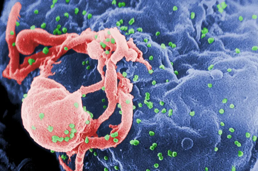 وه‌زاره‌تی ته‌ندرووستی حكوومه‌تی هه‌رێم :  سێ حاڵه‌تی هه‌ڵگری ڤایرۆسی HIV ده‌ستنیشان كران