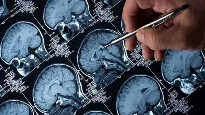 Lêkolînekî nû: Madda Lîtyûmê li hemberê Alzheimerê mêjî diparêze