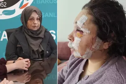 Xebatkarê daîra parastina serokkomariyê ji ber li jina xwe xist, ew şandin zîndanê