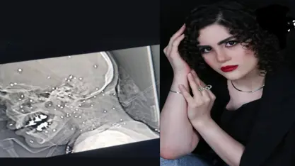 کچێکی تەمەن ٢٢ ساڵ بە تەقەی ڕاستەخۆی هێزە چەکدارەکانی ئێران گیانی لە دەستدا